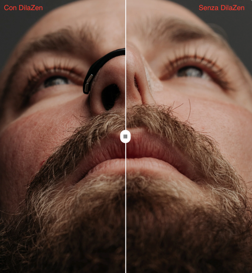 DilaZen™ Starter Kit: Cerottini magnetici nasali