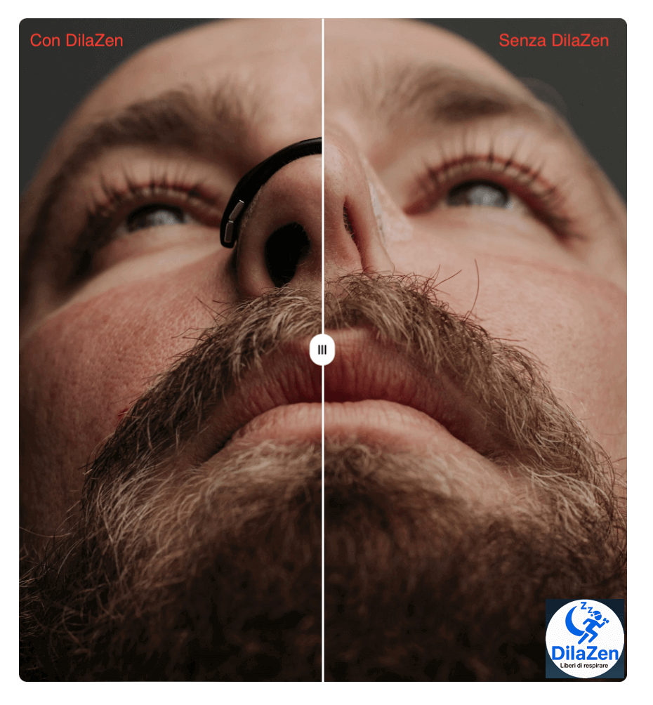 DilaZen™ Starter Kit: Dilatatori Magnetici Nasali